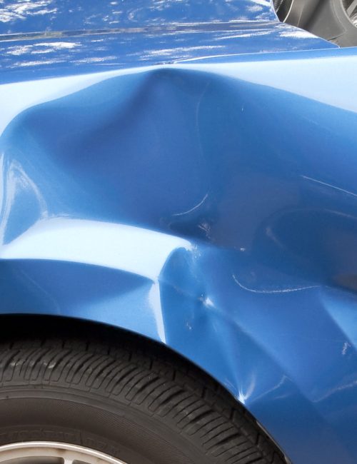 Auto accident leaving a huge dent in the left front quarter panel.